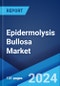 Epidermolysis Bullosa Market: Epidemiology, Industry Trends, Share, Size, Growth, Opportunity, and Forecast 2024-2034 - Product Image