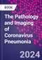 The Pathology and Imaging of Coronavirus Pneumonia - Product Thumbnail Image