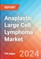 Anaplastic Large Cell Lymphoma - Market Insight, Epidemiology and Market Forecast - 2034 - Product Image