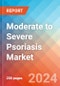 Moderate to Severe Psoriasis - Market Insight, Epidemiology and Market Forecast - 2034 - Product Thumbnail Image