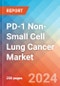 PD-1 Non-Small Cell Lung Cancer (PD-1+ NSCLC) - Market Insight, Epidemiology and Market Forecast - 2034 - Product Image