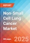 Non-Small Cell Lung Cancer - Market Insight, Epidemiology, and Market Forecast -2034 - Product Image