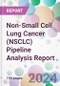 Non-Small Cell Lung Cancer (NSCLC) Pipeline Analysis Report - Product Image