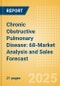 Chronic Obstructive Pulmonary Disease: 68-Market Analysis and Sales Forecast - Update - Product Thumbnail Image