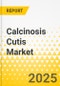 Calcinosis Cutis Market - A Global and Regional Analysis: Analysis and Forecast, 2025-2035 - Product Thumbnail Image