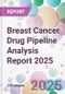 Breast Cancer Drug Pipeline Analysis Report 2025 - Product Thumbnail Image
