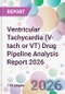 Ventricular Tachycardia (V-tach or VT) Drug Pipeline Analysis Report 2026 - Product Image