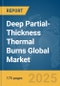 Deep Partial-Thickness Thermal Burns Global Market Report 2025 - Product Thumbnail Image