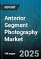Anterior Segment Photography Market by Product Type, End User, Application, Technology, Distribution Channel - Global Forecast 2025-2030 - Product Image