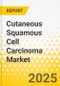 Cutaneous Squamous Cell Carcinoma Market - A Global and Regional Analysis: Focus on Country and Region - Analysis and Forecast, 2025-2035 - Product Thumbnail Image