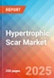 Hypertrophic Scar - Market Insight, Epidemiology, and Market Forecast - 2034 - Product Thumbnail Image