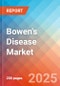 Bowen's Disease - Market Insight, Epidemiology, and Market Forecast - 2034 - Product Thumbnail Image