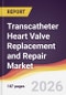 Transcatheter Heart Valve Replacement and Repair Market Report: Trends, Forecast and Competitive Analysis to 2031 - Product Thumbnail Image