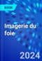 Imagerie du foie - Product Image