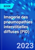 Imagerie des pneumopathies interstitielles diffuses (PID)- Product Image