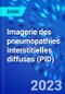 Imagerie des pneumopathies interstitielles diffuses (PID) - Product Image