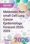 Metastatic Non-small Cell Lung Cancer Epidemiology Forecast 2026-2035 - Product Thumbnail Image
