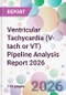 Ventricular Tachycardia (V-tach or VT) Pipeline Analysis Report 2026 - Product Thumbnail Image