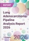 Lung Adenocarcinoma Pipeline Analysis Report 2026 - Product Thumbnail Image