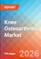 Knee Osteoarthritis - Market Insight, Epidemiology, and Market Forecast - 2036 - Product Thumbnail Image