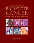 Prostate Cancer. Science and Clinical Practice. Edition No. 2- Product Image