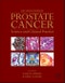 Prostate Cancer. Science and Clinical Practice. Edition No. 2 - Product Thumbnail Image