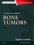 Dorfman and Czerniak's Bone Tumors. Edition No. 2- Product Image