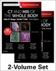 CT and MRI of the Whole Body, 2-Volume Set. Edition No. 6- Product Image
