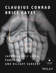 Laparoscopic Liver, Pancreas, and Biliary Surgery. Edition No. 1- Product Image