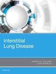 Interstitial Lung Disease- Product Image