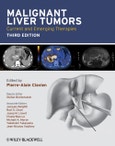 Malignant Liver Tumors. Current and Emerging Therapies. Edition No. 3- Product Image