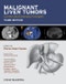 Malignant Liver Tumors. Current and Emerging Therapies. Edition No. 3 - Product Image
