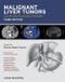 Malignant Liver Tumors. Current and Emerging Therapies. Edition No. 3 - Product Thumbnail Image