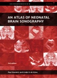 An Atlas of Neonatal Brain Sonography. Edition No. 2. Clinics in Developmental Medicine- Product Image