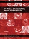 An Atlas of Neonatal Brain Sonography. Edition No. 2. Clinics in Developmental Medicine - Product Image