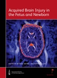 Acquired Brain Injury in the Fetus and Newborn. Edition No. 1. International Review of Child Neurology- Product Image