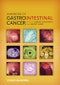 Handbook of Gastrointestinal Cancer. Edition No. 1 - Product Image