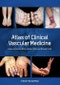 Atlas of Clinical Vascular Medicine - Product Thumbnail Image