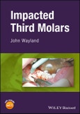 Impacted Third Molars. Edition No. 1- Product Image
