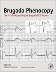 Brugada Phenocopy. The Art of Recognizing the Brugada ECG Pattern- Product Image