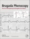 Brugada Phenocopy. The Art of Recognizing the Brugada ECG Pattern - Product Thumbnail Image