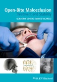 Open-Bite Malocclusion. Treatment and Stability. Edition No. 1- Product Image