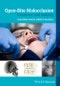 Open-Bite Malocclusion. Treatment and Stability. Edition No. 1 - Product Thumbnail Image