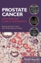 Prostate Cancer. Diagnosis and Clinical Management. Edition No. 1 - Product Thumbnail Image