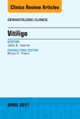 Vitiligo, An Issue of Dermatologic Clinics. The Clinics: Dermatology Volume 35-2- Product Image