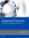 Scaphoid Fractures. Evidence-Based Management- Product Image