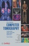 Computed Tomography. Fundamentals, System Technology, Image Quality, Applications. 4th Edition - Product Image