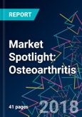 Market Spotlight: Osteoarthritis- Product Image