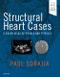 Structural Heart Cases. A Color Atlas of Pearls and Pitfalls - Product Image