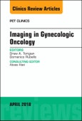 Imaging in Gynecologic Oncology, An Issue of PET Clinics. The Clinics: Radiology Volume 13-2- Product Image
